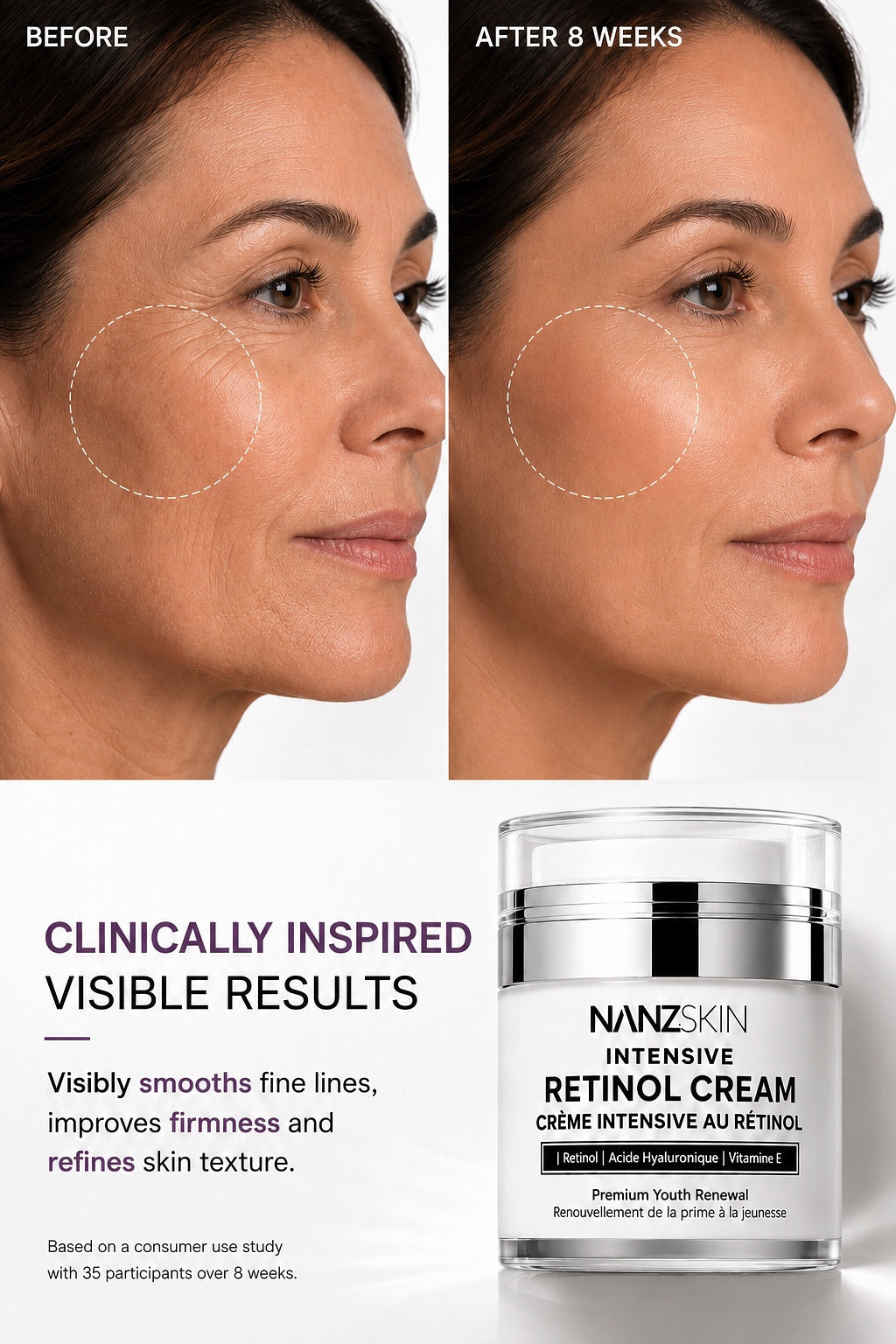 Crème Intensive Rétinol NANZSKIN